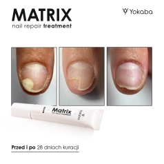 Matrix Nail Repair Treatment Vegan Yokaba 15 ml