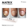 Matrix Nail Repair Treatment Vegan Yokaba 15 ml