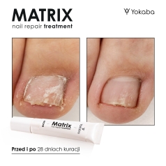 Matrix Nail Repair Treatment Vegan Yokaba 15 ml