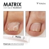 Matrix Nail Repair Treatment Vegan Yokaba 15 ml