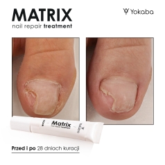 Matrix Nail Repair Treatment Vegan Yokaba 15 ml