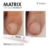 Matrix Nail Repair Treatment Vegan Yokaba 15 ml